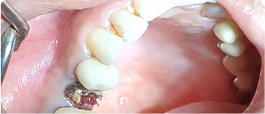 Smile before treatment 2