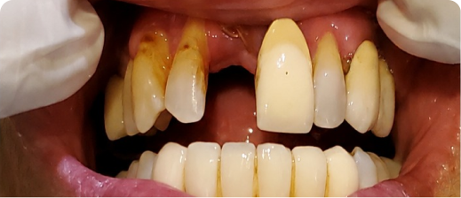 Smile before treatment 3